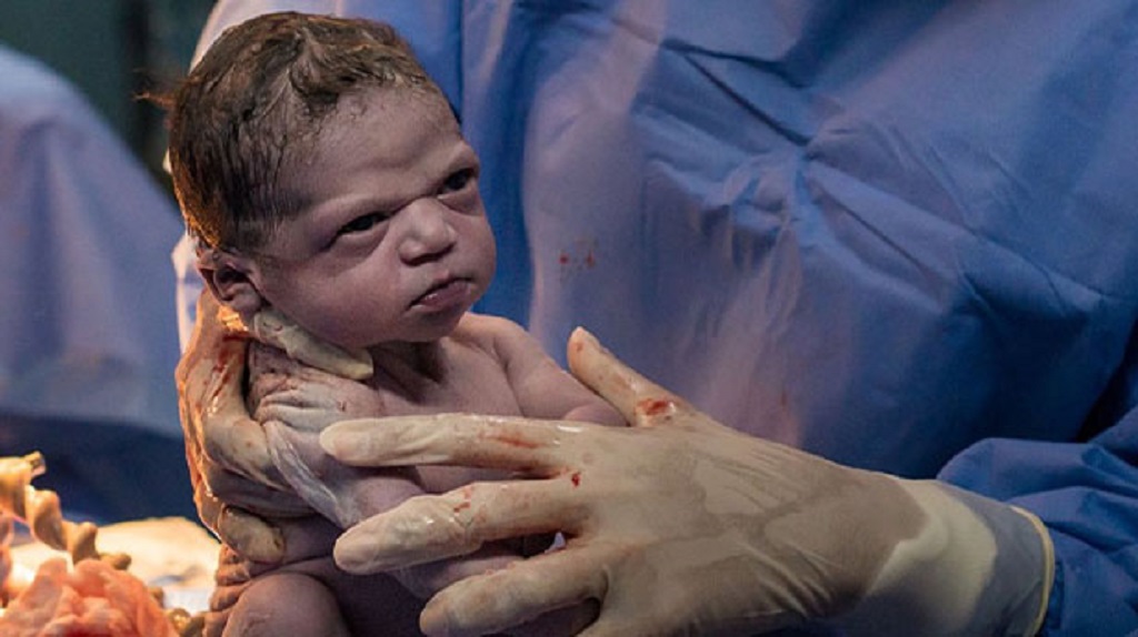 जन्म लेते ही डॉक्टरों पर गुस्सा करने वाली बच्ची कौन है, क्यों हो रही है वायरल?