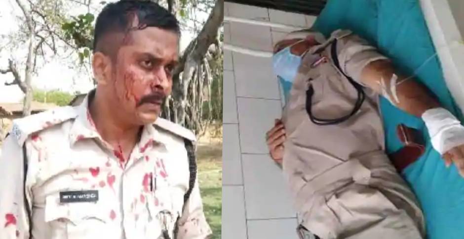 मुरादाबाद में डॉक्टर-पुलिस पर हमले को मीडिया ने दिखाया पर औरंगाबाद हमले को क्यों नहीं?